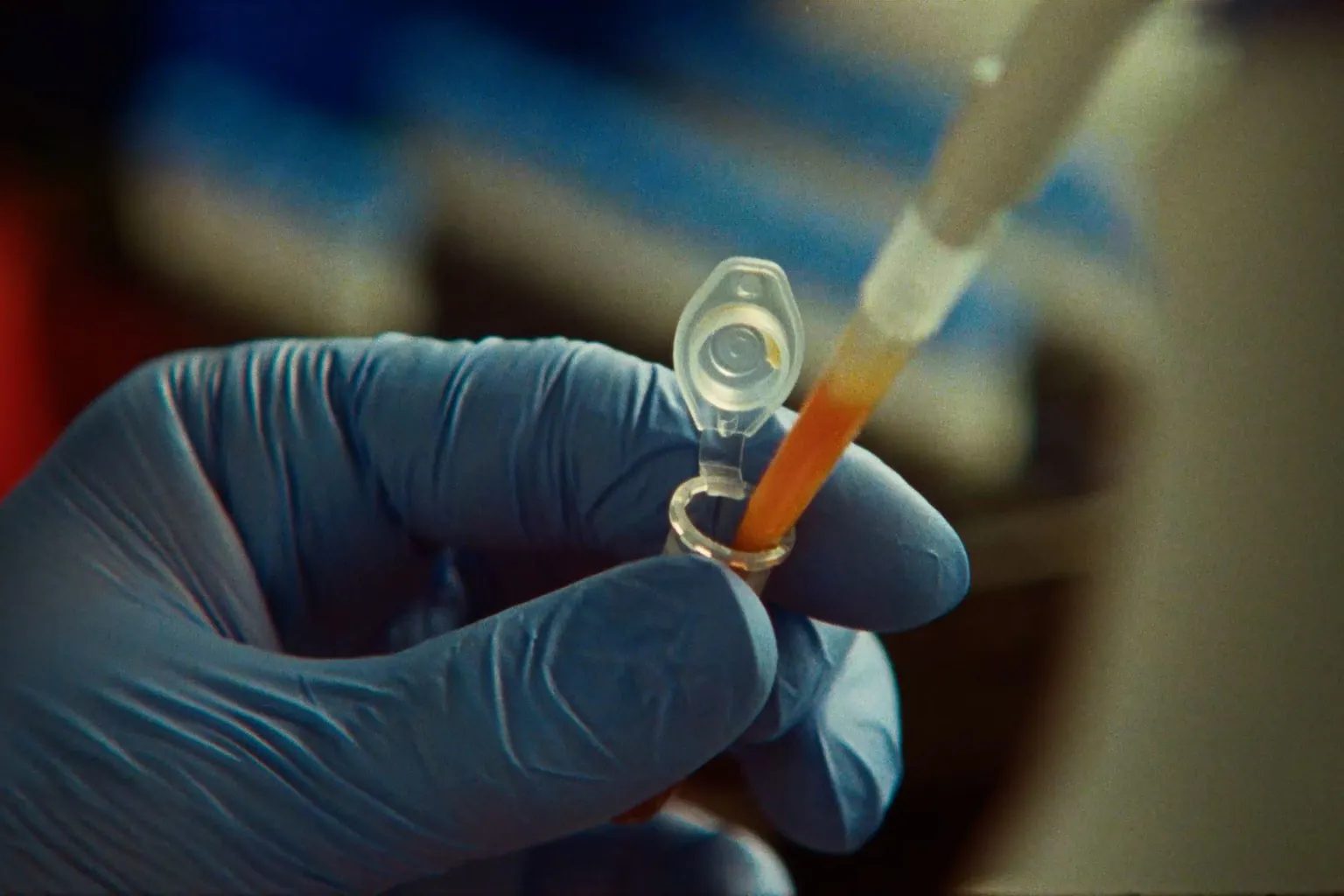 Claude's 'New' Enzyme Was Already Known, Experts Say